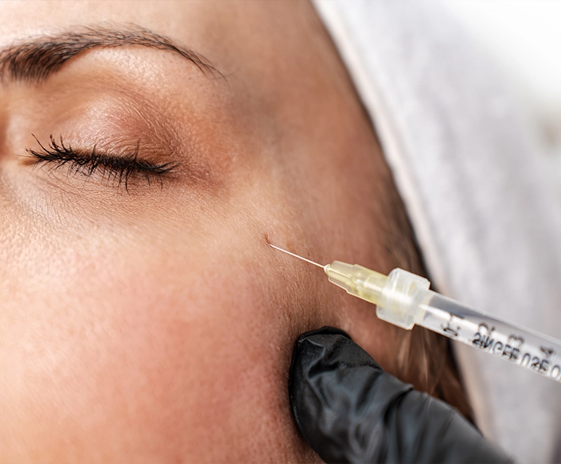 injection acide hyaluronique