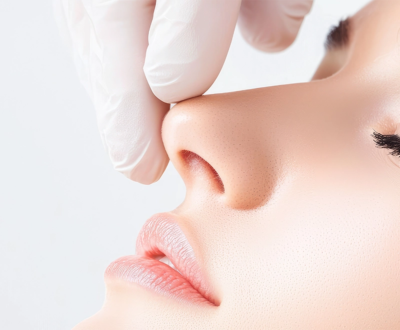 chirurgie nez