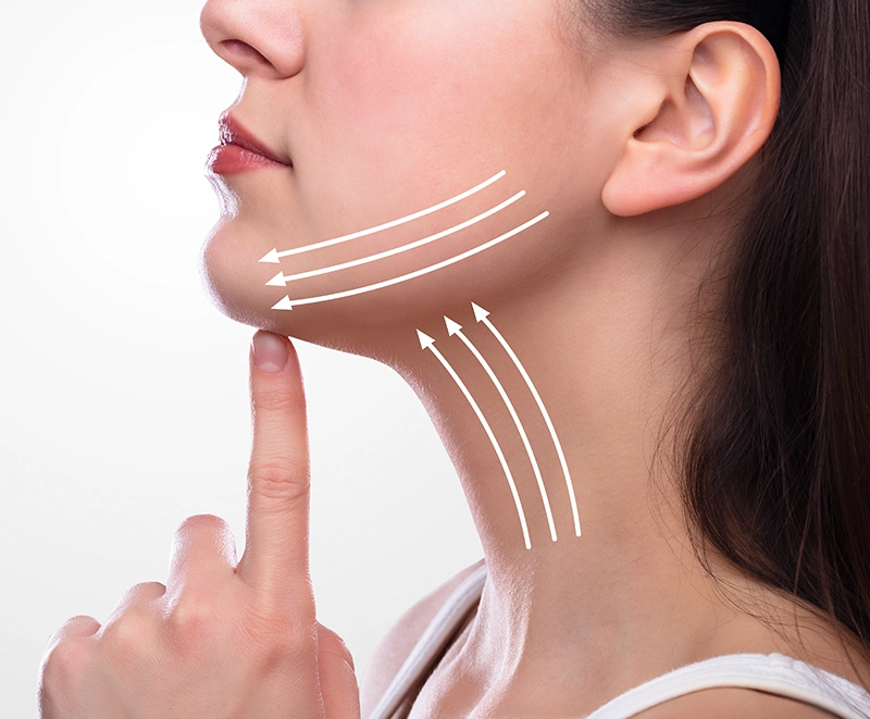 Lipoaspiration du cou
