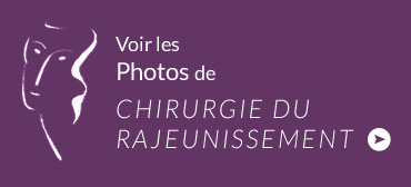 photo rajeunissement